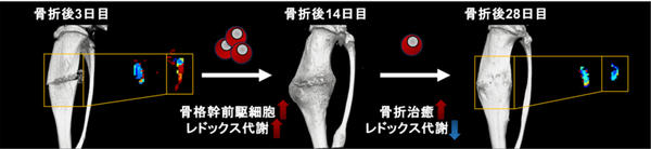 図3: 仮骨のレドックス動態は骨格幹前駆細胞の代謝活性を反映し，骨再生の機能的評価につながる