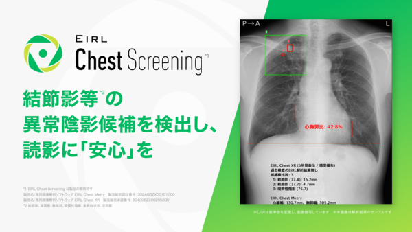 EIRL Chest Screening