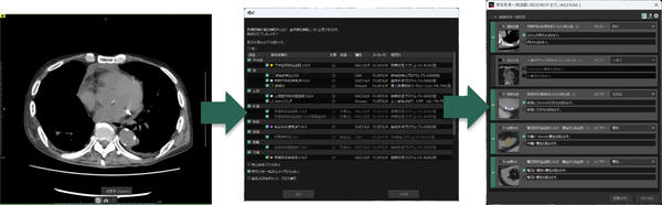 図6：複数の定型文を一括でレポート送信する「存在所見一括送信」機能の表示例。一括表示を選択すると処理が実行されたSAIフィルタで検出された結果の一部をもとに，関連する内容をまとめた定型文が自動的に表示される。