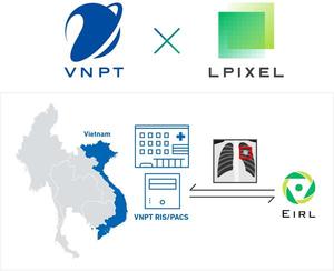 ベトナム大手通信VNPT-ITとエルピクセルが画像診断支援AIの販売提携を締結