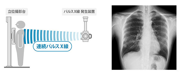 「X線動態」のイメージ図