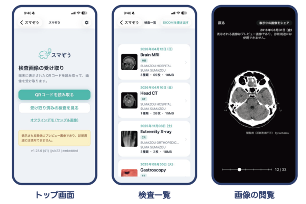 スマぞうアプリ（トップ画面／検査一覧／画像の閲覧）　※本アプリは検査画像の保管・閲覧を目的としたもので，診断・読影を目的としたものではない。