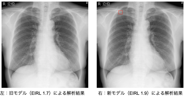 旧モデルでは検出できなかったが新モデルで検出できた例