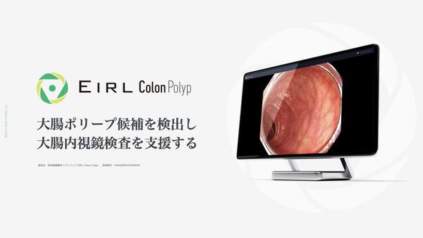 EIRL Colon Polyp