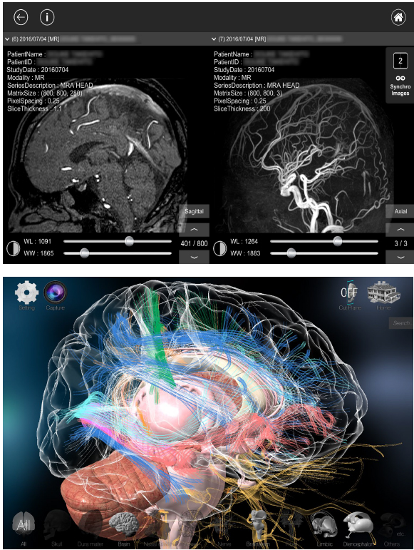 （写真[上]＝タブレット型医用画像ビュワー，写真[下]＝3D解剖画像可視化ソフトウェア）【Kompath提供】