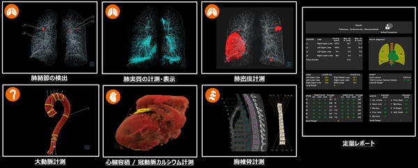 AI-Rad Companion Chest CTによる解析のイメージとレポート画面