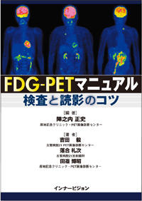 FDG-PETマニュアル 検査と読影のコツ