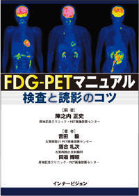 FDG-PETマニュアル　検査と読影のコツ