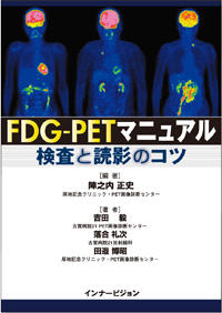 FDG-PETマニュアル　検査と読影のコツ