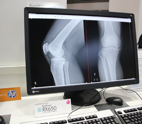 30型ワイド6MPカラー液晶モニタの「RadiForce RX650」を参考展示