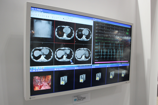 手術室向け47インチの「RadiForce LX470W」