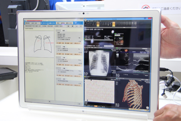 4Kタブレットは電子カルテ（左）と医用画像システム（右）を並べて表示可能