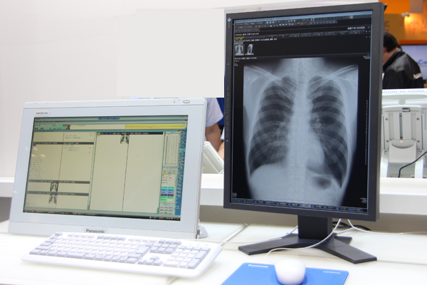 PACS一体化電子カルテ「Medicom-HRII」と「Plissimo AR」