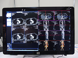 3D画像作成に対応したsyngo.plaza 3D+