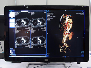 2D画像と3D画像を並列表示して読影を支援