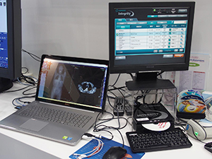 外部医療機関からの画像取り込みソリューション