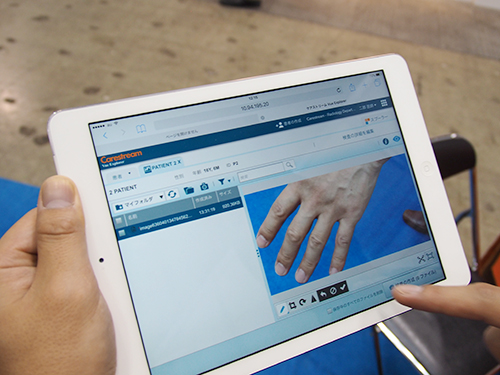 iPadで皮膚の状態を記録するために手の写真を撮影し患者を指定して登録