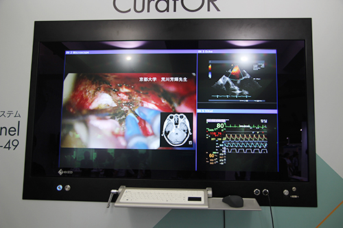 情報集約操作システム「CuratOR Surgical Panel SP1-49」（49インチ）