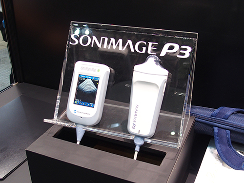 手のひらサイズの超音波診断装置「SONIMAGE P3」