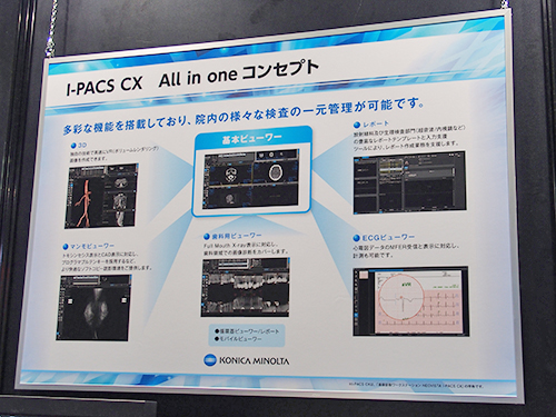 ビューワが高機能化した「NEOVISTA I-PACS CX All in oneコンセプト」