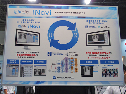 読影を支援する“iNavi”