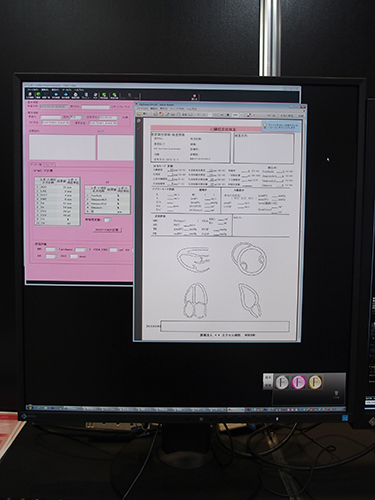 心臓超音波検査のレポート画面