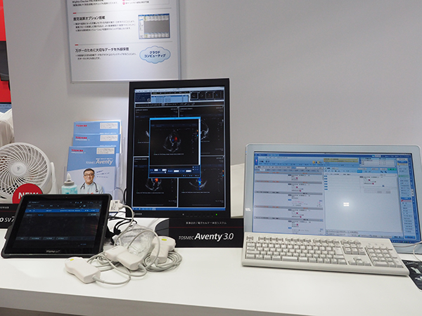診療所向け電子カルテシステム「TOSMEC Aventy 3.0」とタブレット型超音波診断装置「Viamo sv7」の連携