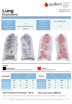 AI画像解析システム「quibim」