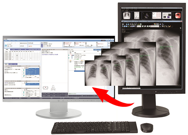 画像ビューア一体型 電子カルテシステム　「Hi-SEED W3 EXV」