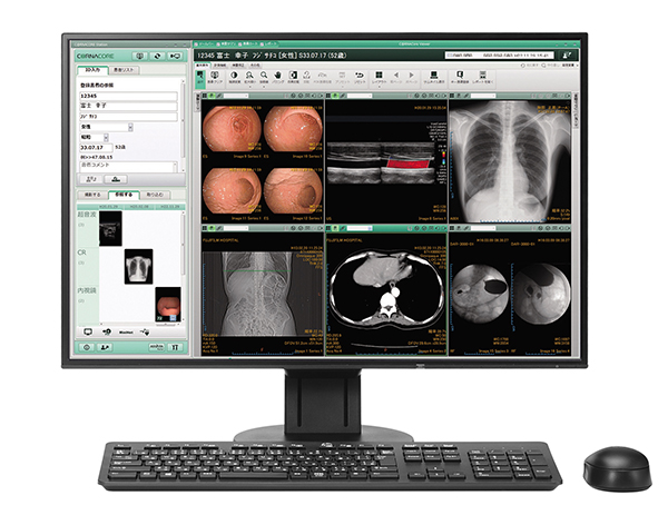 富士画像診断ワークステーション「C@RNACORE」