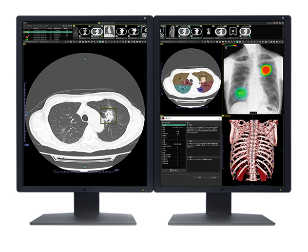 AIプラットフォーム「SYNAPSE SAI viewer」　