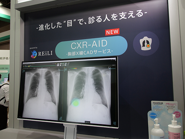 CXR-AIDの胸部X線CADサービスもクラウドで利用できる