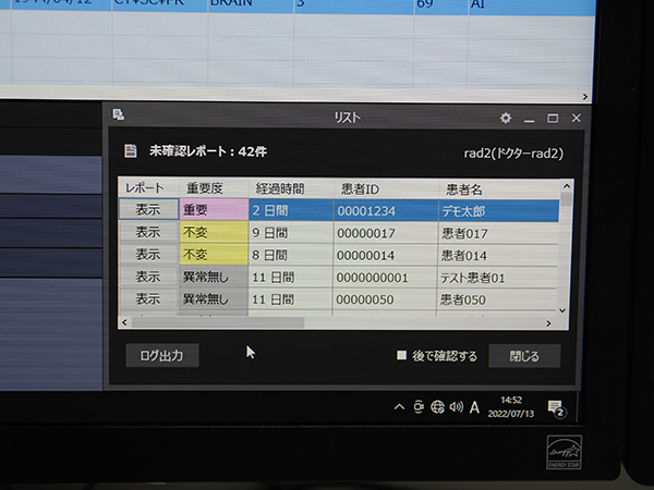 読影レポートの見落としを防止する「INFINITT PACS 7.0」の既読管理機能
