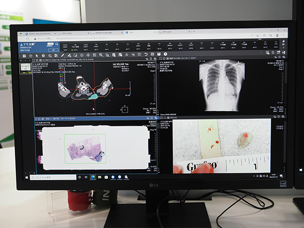 DICOMデータと非DICOMデータを統合表示できる“ULite”
