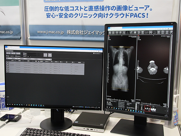 新規開業医向けクラウド型PACS「ClimisクラウドPACS」