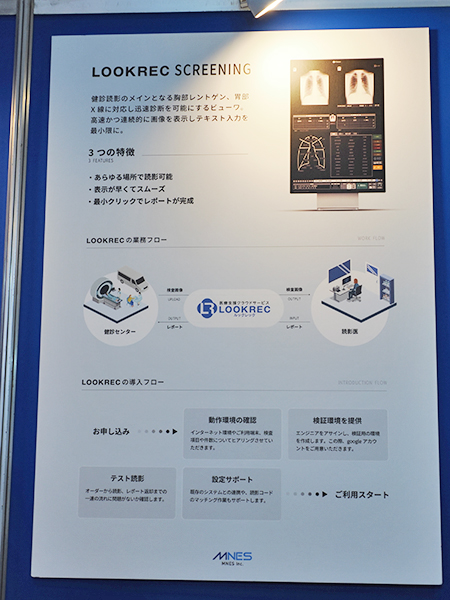 胸部X線画像や胃部X線画像を速やかに読影できる“LOOKREC Screening”
