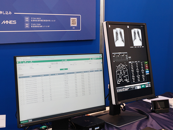 レポート作成も容易に行える健診読影専門ビューワ“LOOKREC Screening”