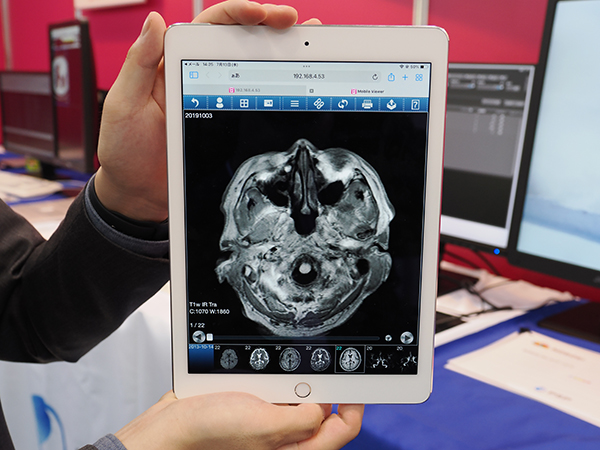 施設外からiPadなどで画像を参照できる「TSUNAGU」