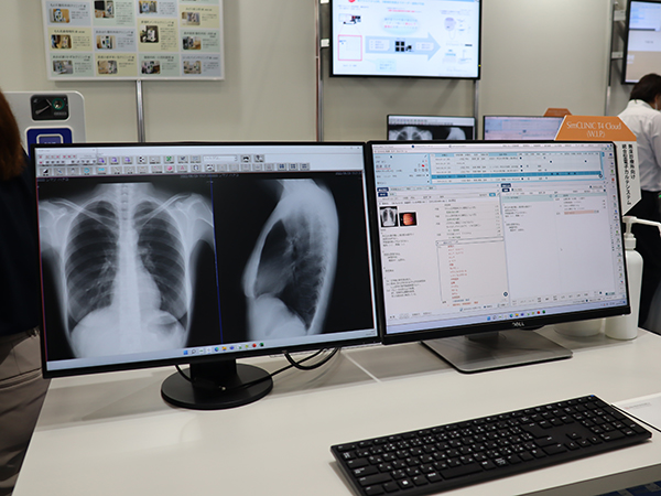画像表示システムと連携可能な電子カルテシステム「SimCLINIC T4 Cloud」（W.I.P.）