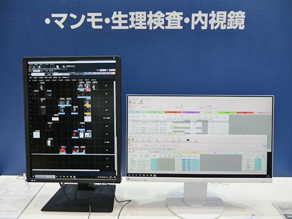 患者データを時系列表示するLine-View機能が特徴のPACS