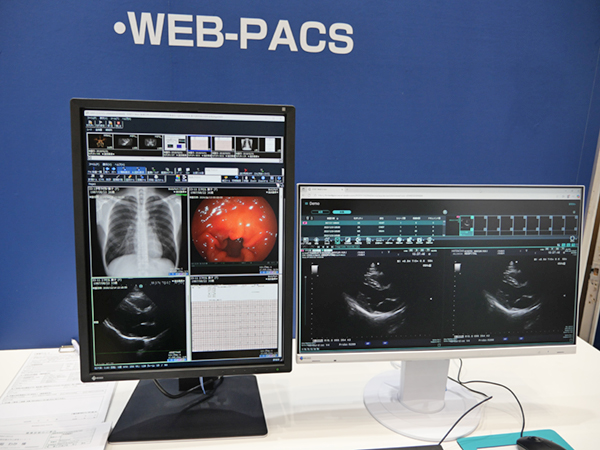 WEBビューワで院内の電子カルテ端末からも画像参照を可能にするWEB-PACS