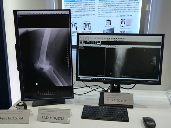 高解像でリーズナブルな医用画像参照用ディスプレイをラインアップ
