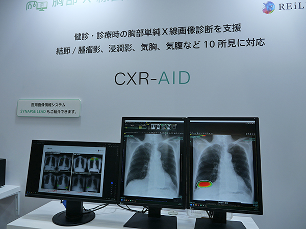 胸部X線画像病変検出ソフトウェアの新バージョン「CXR-AID Ver3.0」を展示