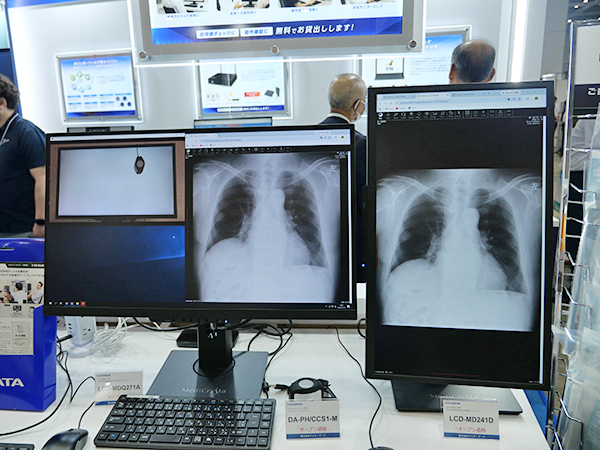 医用画像参照用ディスプレイ「MediCrysta LCD-MDQ271A」と「MediCrysta  LCD-MD241D」を展示