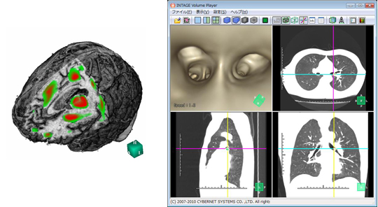 3D医用画像処理ソフト『RealINTAGE』（リアルインテージ） ■3Dボリュームプレーヤ『INTAGE Volume Player5』（インテージボリュームプレーヤ5）