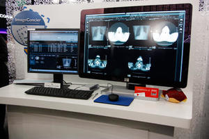 画像診断ワークステーション「ImageConcier ICW-1000」 “診療データコックピット”では，直感的な操作で，患者ごとの検査履歴を俯瞰的に確認できる。