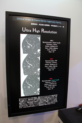 Ultra High Resolution撮影でのiDose4の効果を比較したパネル