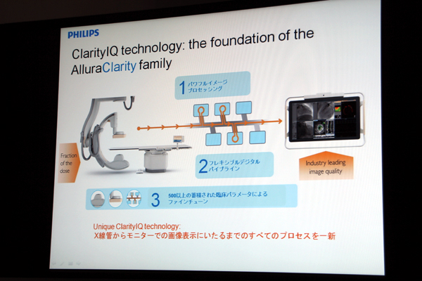 新しい血管撮影装置Allura Clarityの画像処理技術ClarityIQの説明図