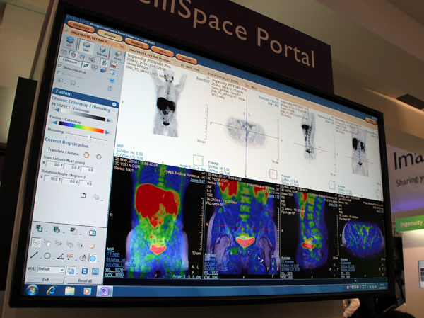 IntelliSpace Portalで表示された前立腺がんのPET/MR画像