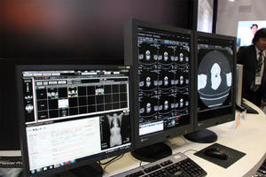 統合型画像診断部門システムのXTREKの最新バージョンを紹介